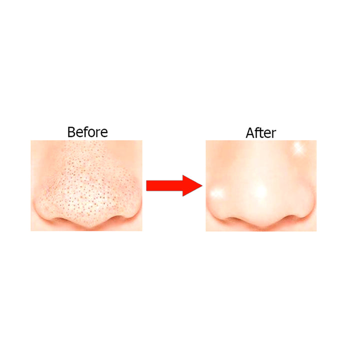 Nu-Pore Deep Cleansing Nose Strips Blackhead Removal Pore Fresh Clean Pack New