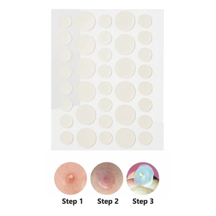 72 Count Hydrocolloid Patches Acne Control Treat Pimples Blemishes Patch Zits