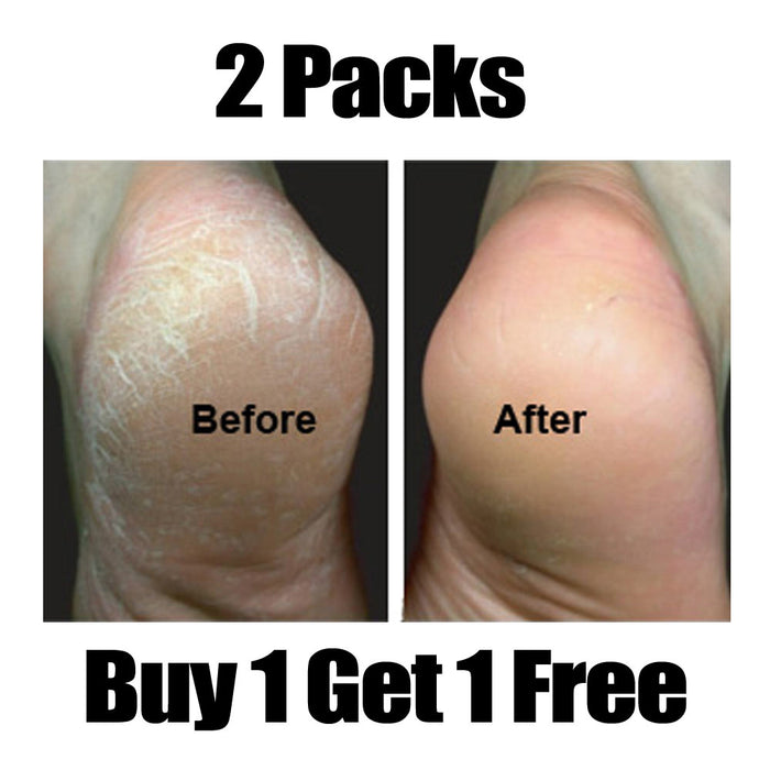 2 Pair Moisturizing Socks Foot Spa Home Treatment Aloe Skin Moisture Dry Feet !!