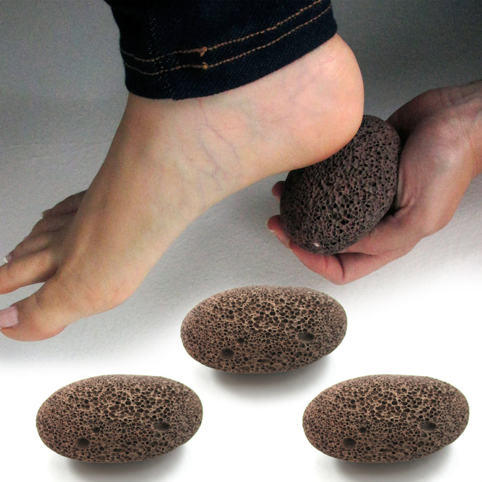 3 Natural Volcanic Lava Pumice Stone Foot Skin Pedicure Callus Dead Skin Remover