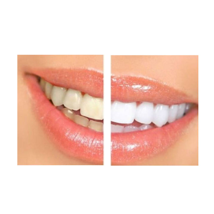 2 Packs White Professional Strength Instant Teeth Whitening Pens Clean Bleaching
