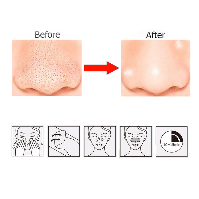 12 Pks Blackhead Remover Deep Cleansing Black Mud Mask Acne Pore Strip Cleanser