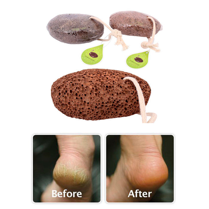 2 Volcanic Lava Pumice Stone Foot Massage Scrub Exfoliate Pedicure Grinding New