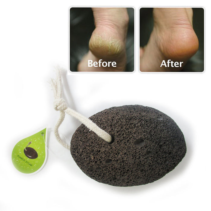 1 Natural Lava Pumice Volcanic Foot Stone Scrubber Dead Skin Callus Remover Care