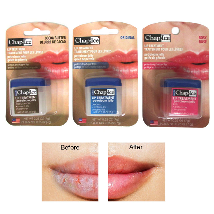 3 Pc Chap Ice Lip Treatment Therapy Balm 0.25 Oz Flavors Petroleum Jelly Lipbalm